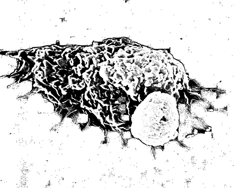 5 Микрофотография лимфоцита